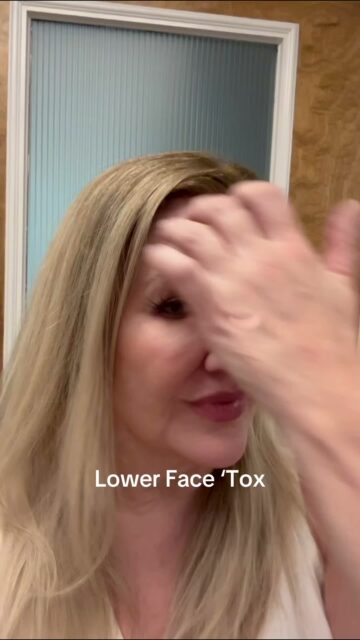 Stop settling for a heavy lower face. 🛑
If you&rsquo;re tired of the "Resting Bitch Face" (RBF), jowls, or stubborn chin dimples, it&rsquo;s time to talk about the Lower Face Transformation.
By strategically placing neuromodulators (aka &lsquo;tox) along the mandible, we can target specific muscles to lift, contour, and smooth. Here is the breakdown of what we&rsquo;re actually treating:
 Platysmal Bands: Smoothing those neck cords for a sleeker, more youthful profile.
 DAO (Depressor Anguli Oris): Relaxing these muscles to instantly lift the corners of the mouth and soften marionette lines.
 Mentalis: Banishing that chin crease and dimpling for a smooth, relaxed, and refined chin.
 Jawline/Jowls: A targeted approach to reduce that heavy, downward pull, creating a lifted, snatched appearance.
The result? A softer, more refreshed lower face that looks like you&mdash;just better rested and more contoured.
Ready to sculpt your jawline? Drop a "CONTOUR" in the comments and let&rsquo;s get you scheduled.
#LowerFaceContour #JawlineGoals #ToxResults #MedSpaAustin #Longevity