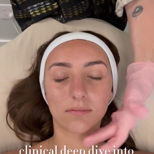 Austin ladies&mdash;still waiting until fall to fix your skin? Don&rsquo;t. ☀️✨

Meet the treatment that&rsquo;s right for everyone: PRX.

Get brighter, smoother, firmer skin with no peeling, no needles, and no downtime. Unlike traditional chemical peels, PRX lets you enjoy everything summer has to offer while stimulating collagen beneath the surface for real, lasting results.

Join us Thursday, July 16 for our exclusive PRX Summer Glow Event and see why this treatment is becoming a favorite for women who want healthier, more radiant skin&mdash;without putting life on pause.

✔️ Improve fine lines
✔️ Brighten sun damage & pigmentation
✔️ Smooth acne scars & texture
✔️ Boost collagen naturally
✔️ Back to your day immediately

✨ Limited event appointments available.

Book your PRX treatment through the link in bio today, and discover why women across Austin are making the switch to no-downtime skin rejuvenation.

📍Simple Radiance Med Spa | Austin, Texas

#AustinMedSpa #AustinSkincare #PRX #SkinRejuvenation #CollagenBoost
