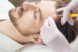 male-forehead - SimpleRadianceMedSpa - SimpleRadianceMedSpa Everything You Need to Know About Sculptra Treatments at Simple Radiance Medspa in Austin